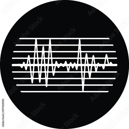 ECG heart rhythm monitor tracing graph.