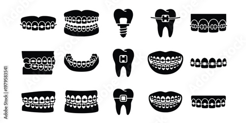 Orthodontic dental braces icons set, 15 black vector elements for tooth alignment, dental implant and stomatology clinic branding