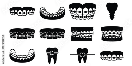 Orthodontic braces and dental treatment icons, 12 vector silhouettes of teeth with metal brackets, dental implant and alignment correction set