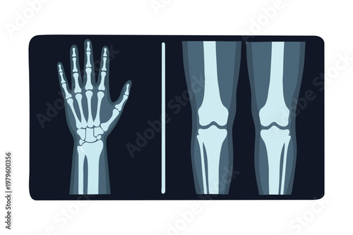 Xray of human hand and knees, medical diagnostic imaging of bones