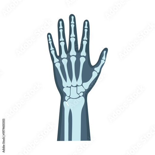 Xray of human hand, medical diagnostic imaging of bones