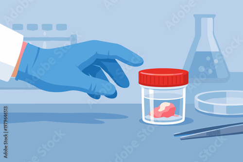 Medical laboratory vector illustration of a gloved hand reaching for a sterile container with a tissue biopsy sample, including laboratory equipment like a flask, petri dish, and tweezers.