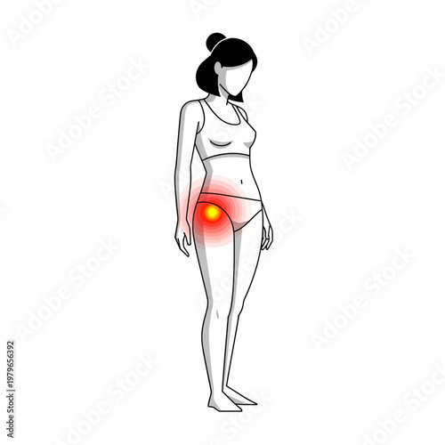 Woman with hip pain, inflammation highlighted in red and yellow