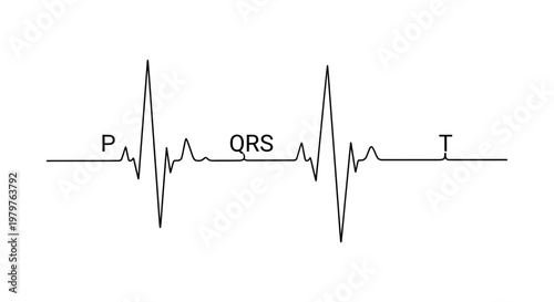 ECG Heartbeat Electrocardiogram Waveform Pattern.