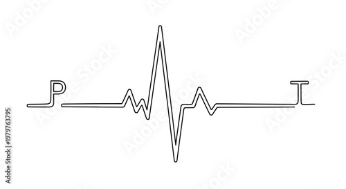 ECG Heartbeat Line Graph Signal.