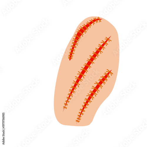 Vector illustration of a wound stitch. Flat design of a stitched wound. Illustration of a wound stitch on the skin