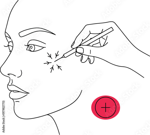 Minimalist line drawing of woman face receiving cosmetic injection procedure