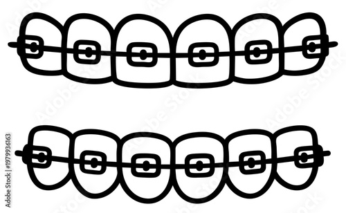 Orthodontic Braces on Teeth Dental Bracket System for Bite Correction and Teeth Alignment