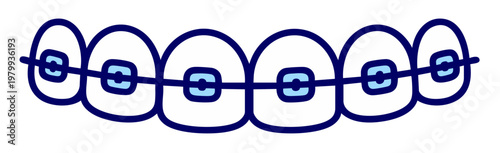 Dental Braces on Teeth Front View, Orthodontic Bracket System for Teeth Straightening