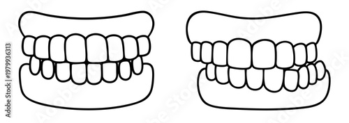 Correct and incorrect bite teeth alignment dental occlusion jaw movement malocclusion orthodontic problem uneven contact of teeth dental comparison line icon