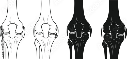 Human knee joint anatomy vector set featuring line art and black silhouettes of femur tibia and patella for medical education orthopedic surgery and healthcare.