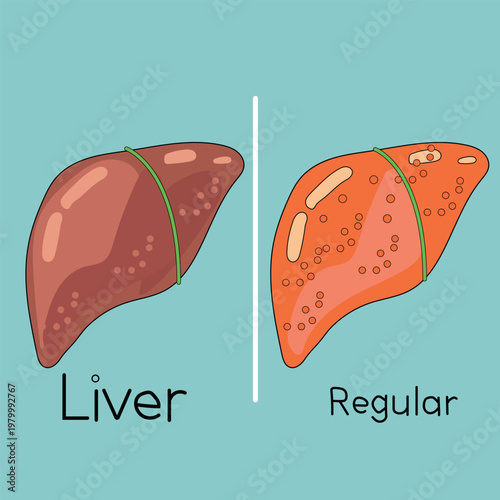 Healthy and damaged liver comparison medical concept vector