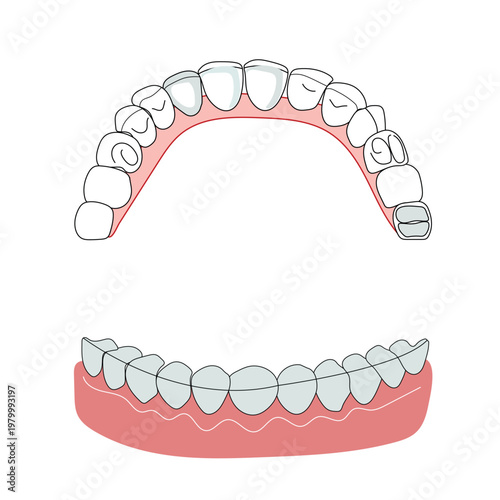 Orthodontic teeth alignment diagram upper lower jaw dental anatomy