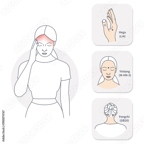 Acupressure points for tension headache relief on hand, forehead and neck