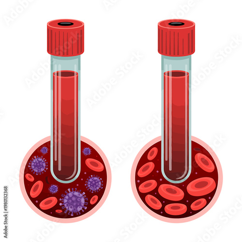 Blood test tubes with infected and normal blood samples side by side comparison