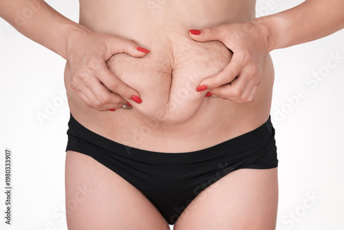 Photos Closeup of woman's hands with red nails pinching excess skin and fat on her stomach