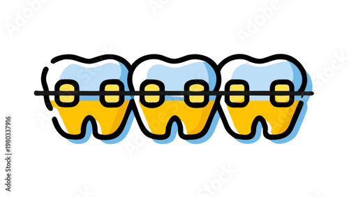 Dental Braces Illustration