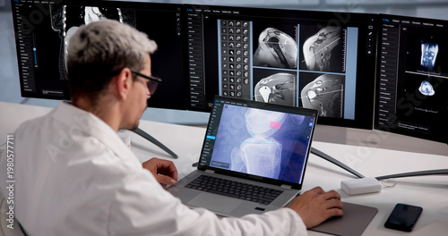 Tableau sur toile Orthopedic Specialist Analyzes Knee X-Ray Image
