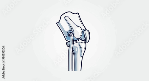 Detailed schematic illustration of a human knee joint, showing bones, cartilage, and ligaments