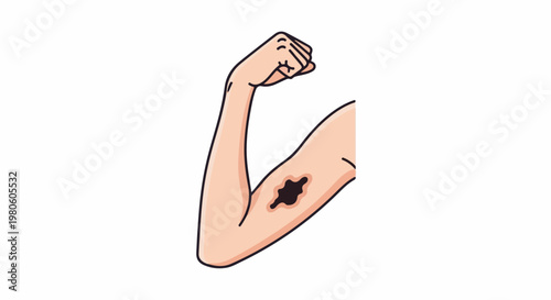 Arm flexed showing a dark irregular mark on the skin