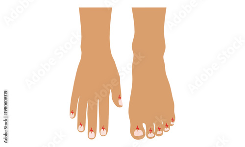 Nerve Pain Sensation in Human Hand and Foot Illustration