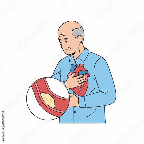 Senior man suffering heart attack with atherosclerosis illustration