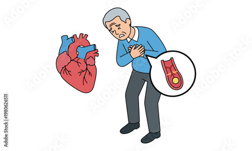 Elderly man having heart attack with clogged artery illustration