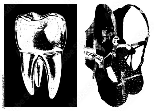 Human molar tooth structure, dental anatomy illustration, skull with protective mask, dental hygiene, medical education graphic, black and white halftone style.
