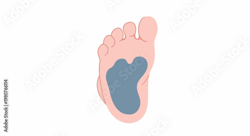 A cartoon illustration of a human foot with a blue arch imprint