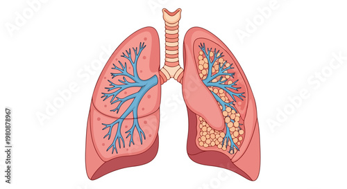 Detailed illustration of the human respiratory system showing lungs, bronchi, and trachea on a white background