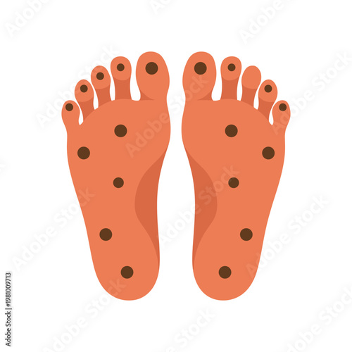 Soles of two feet with brown spots orange reflexology