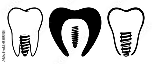 Dental implant tooth icon set with solid black shape on white background featuring dental implant, tooth, icon with vector and minimalist design