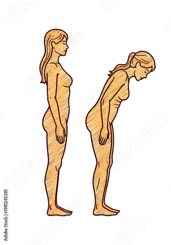 Illustration of a woman with good posture standing upright next to a woman with poor posture bending forward.