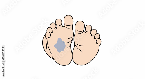 Close-up cartoon illustration of the soles of two feet, one with a grey mark