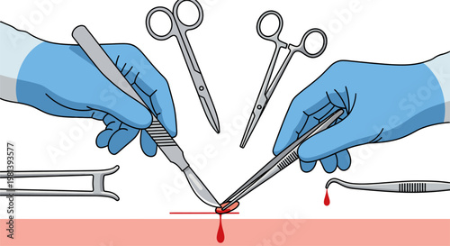 Close-up vector illustration of a surgical procedure with gloved hands holding a scalpel and forceps. Concept of surgery, incision, and medical treatment.