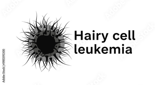 Hairy cell leukemia (HCL) medical illustration showing a stylized lymphocyte with fine, hair-like cytoplasmic projections.