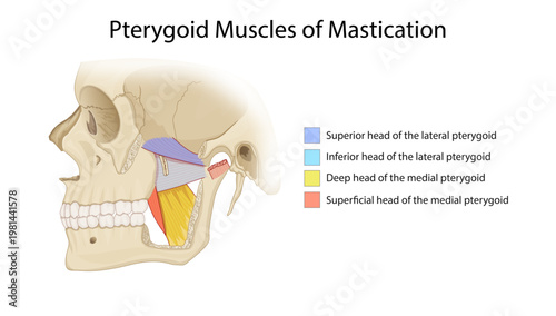 Pterygoid Muscles of Mastication
Diagram showing medial and lateral pterygoid muscles and their heads involved in jaw movement.