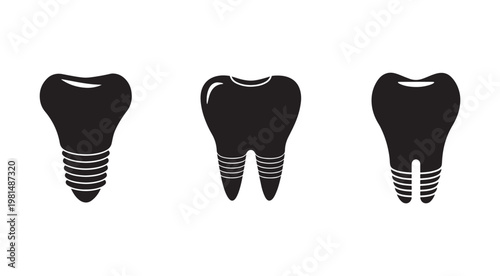 Dental implants and teeth with screw threads for secure fixation in jawbone for chewing and aesthetic purposes  dental health concept