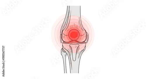 A precise anatomical diagram presents a frontal view of the human knee joint with a vibrant red circular glow highlighting a specific area of discomfort.