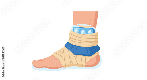 A meticulous illustration of a human ankle wrapped in a beige compression bandage featuring a blue ice pack for injury recovery on a clean white backdrop.
