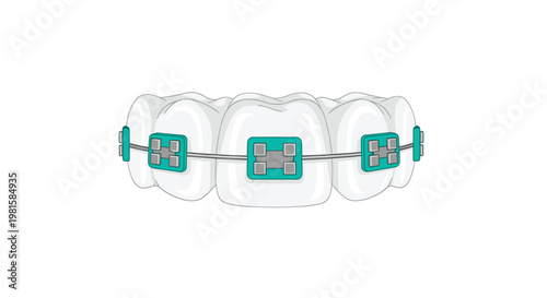 A row of pristine white human teeth features meticulously attached teal orthodontic brackets and silver wires against a clean and minimalist white background.