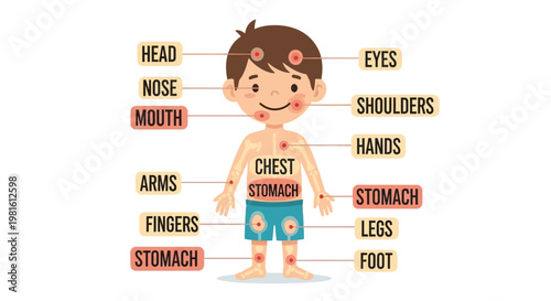 A cartoon illustration of a young boy with labeled body parts and red spots indicating a rash or illness.