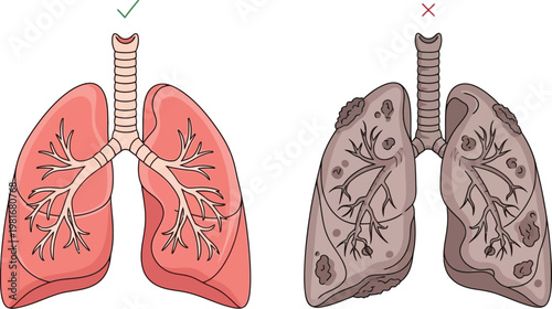 This educational illustration starkly contrasts a vibrant, healthy human lung with a diseased, damaged lung, emphasizing respiratory health and the impact of harmful habits.