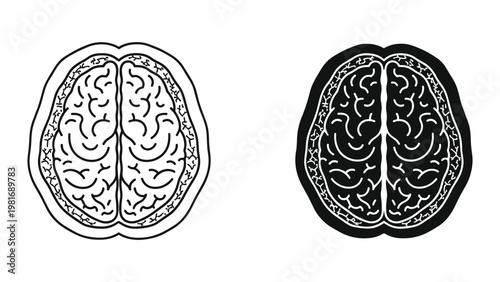 Brain scan activity comparison medical image