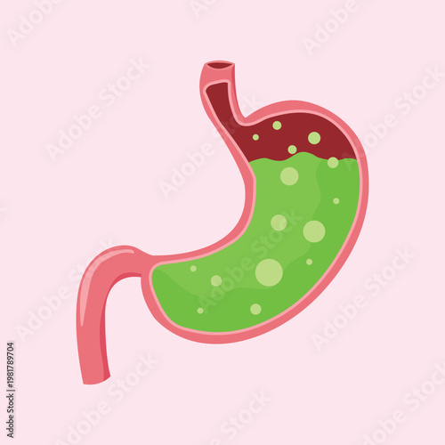 Detailed illustration of the human stomach organ showing digestive acid and internal processes, symbolizing gastrointestinal health or discomfort