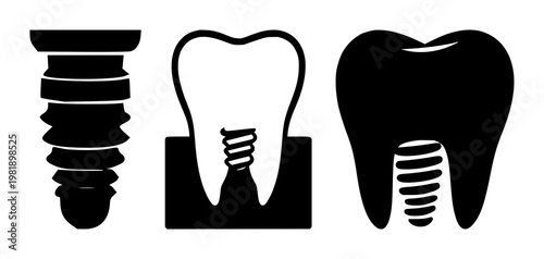 Dental implant tooth icon set with solid black shape on white background featuring dental implant, tooth, icon with vector and minimalist design