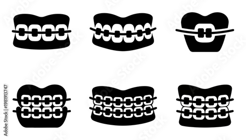 Vector of teeth with various types of braces and dental appliances