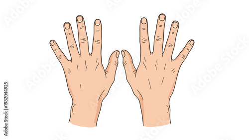 Anatomical illustration of two human hands with palms facing forward showing skin texture and fingernail details on a white background.