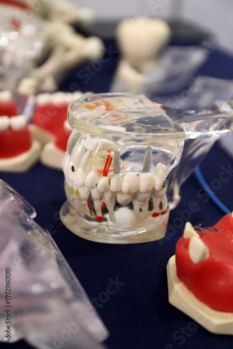 prótesis dentales y tratamientos dental