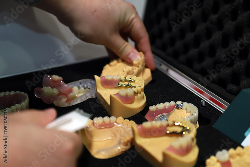 prótesis dentales